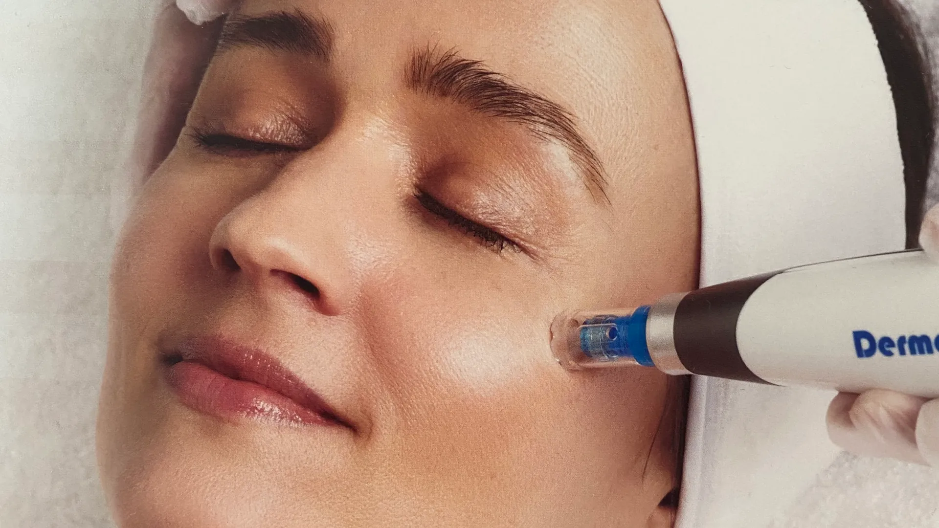 MEDICUM Longevity & Beauty medycyna estetyczna Toruń kosmetologia zabiegi frakcyjne mikronakłuwanie skóry 4.0 naturalna odnowa skóry grafika