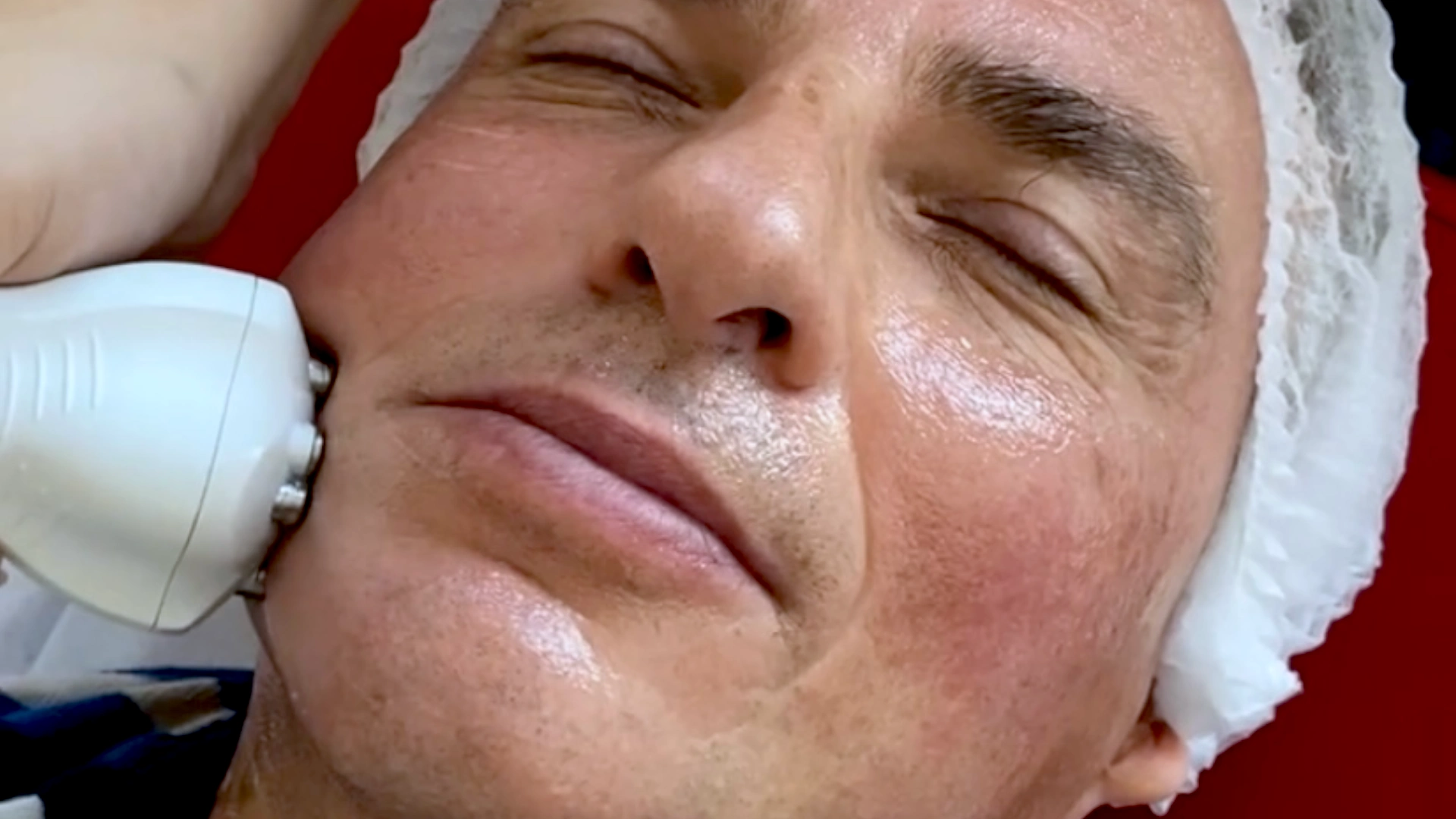 MEDICUM Longevity & Beauty medycyna estetyczna Toruń kosmetologia zabiegi liftingujące poprawa owalu twarzy zwiększenie elastyczności zagęszczenie skóry wygładzenie zmarszczek grafika glowna