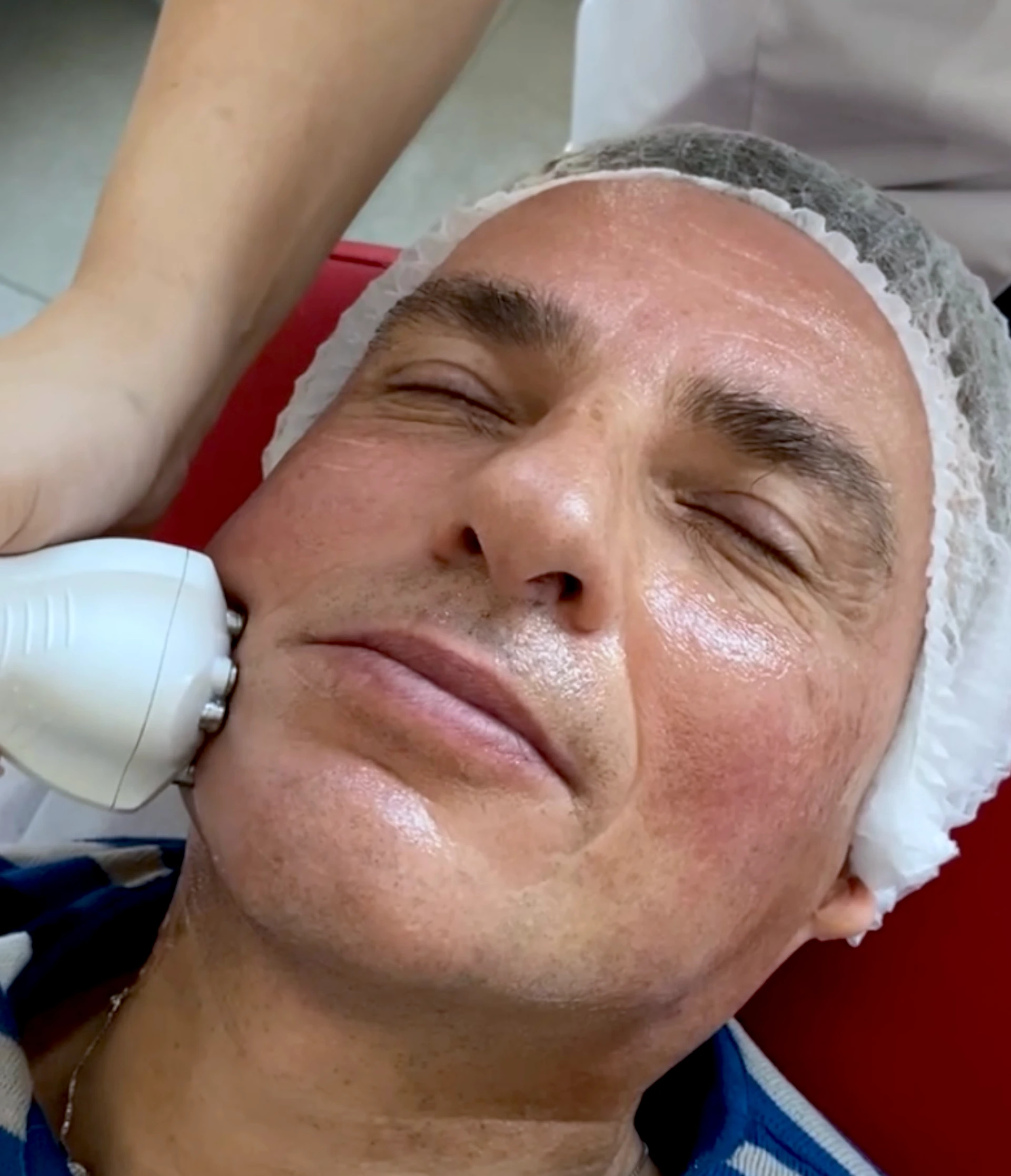 MEDICUM Longevity & Beauty medycyna estetyczna Toruń kosmetologia zabiegi liftingujące poprawa owalu twarzy zwiększenie elastyczności zagęszczenie skóry wygładzenie zmarszczek grafika pionowa