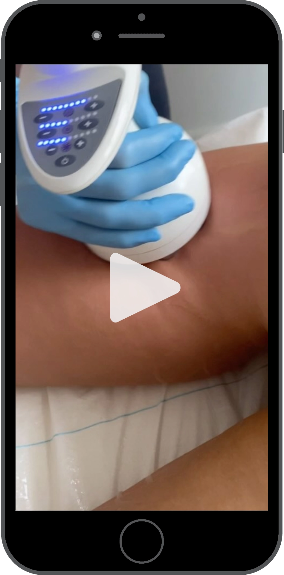 MEDICUM Longevity & Beauty klinika medycyny estetycznej Toruń zabiegi kosmetologia estetyczna medycyna estetyczna przykładowe zabiegi wysmuklanie ud technologia 4D smartfon