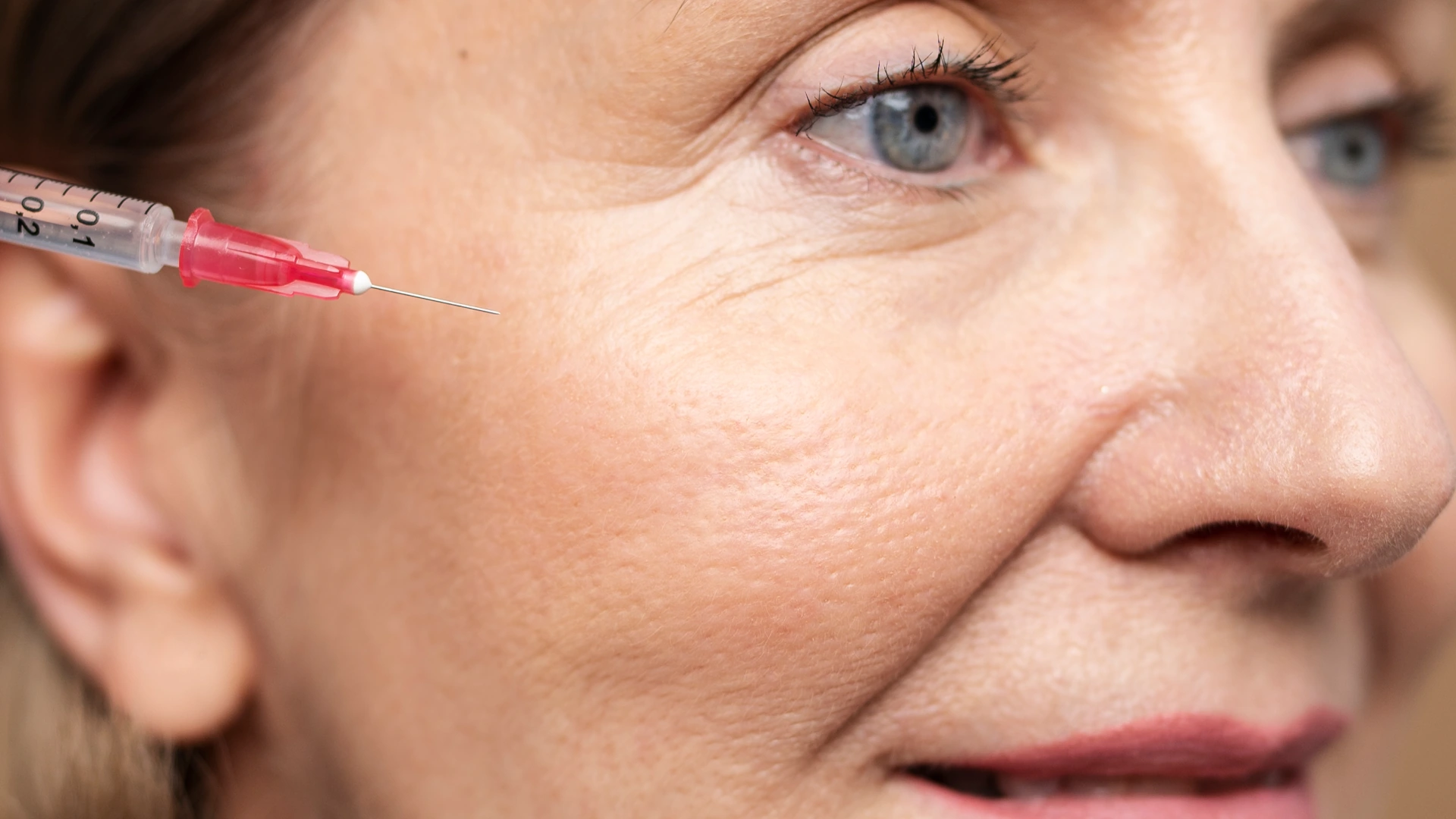 MEDICUM Longevity & Beauty medycyna estetyczna Toruń kosmetologia zabiegi kwas hialuronowy wypełnienie zmarszczek modelowanie konturu twarzy głębokie nawilżenie skóry
