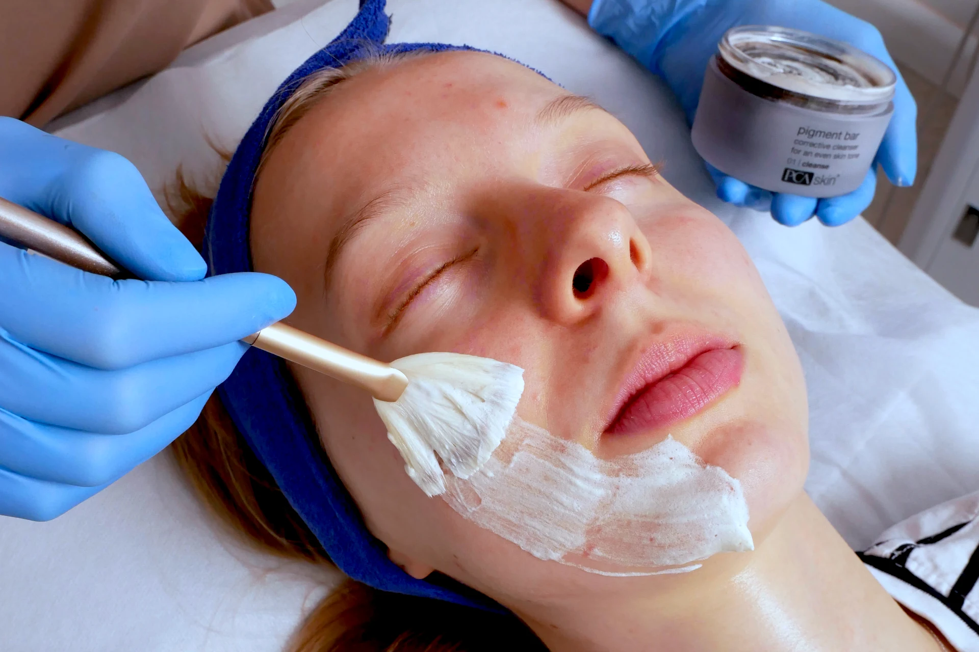MEDICUM Longevity & Beauty medycyna estetyczna Toruń kosmetologia zabiegi nierówny koloryt skóry przebarwienia skóry peeling traneksamowy peeling azelainowy peelingi chemiczne