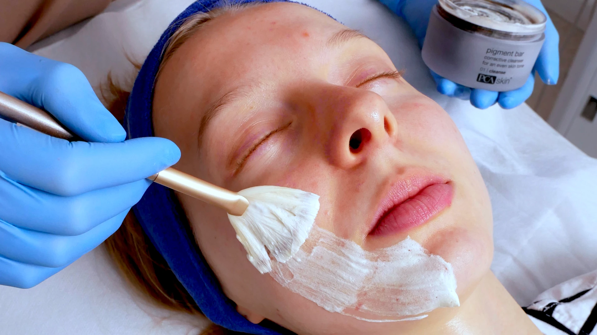 MEDICUM Longevity & Beauty medycyna estetyczna Toruń kosmetologia zabiegi terapie PCA Skin z zastosowaniem peelingów chemicznych lub masek terapeutycznych detoks odnowa balans skóry twarzy